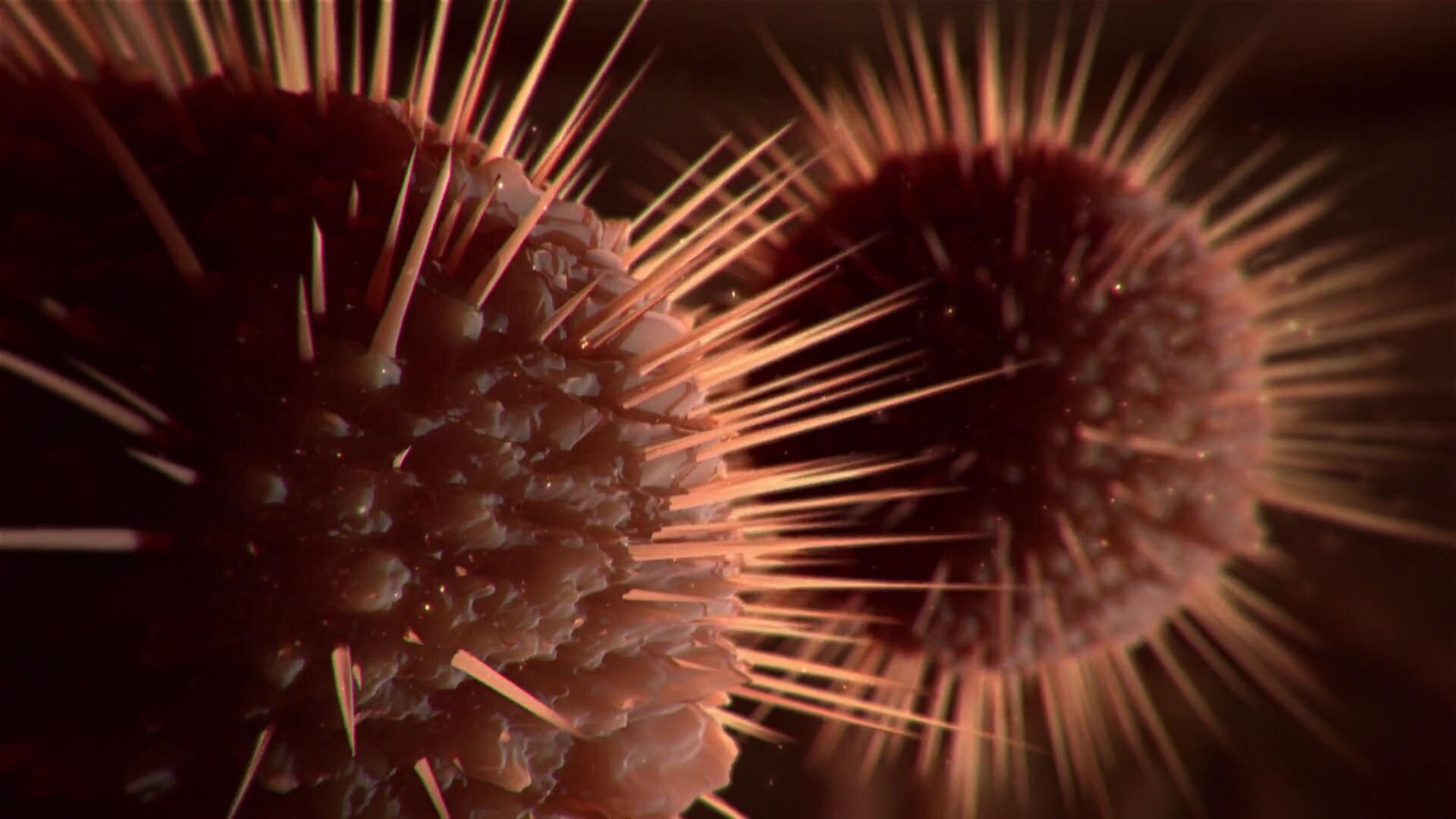 Monsters Inside Me S8E3 My Second Brain Is Killing Me