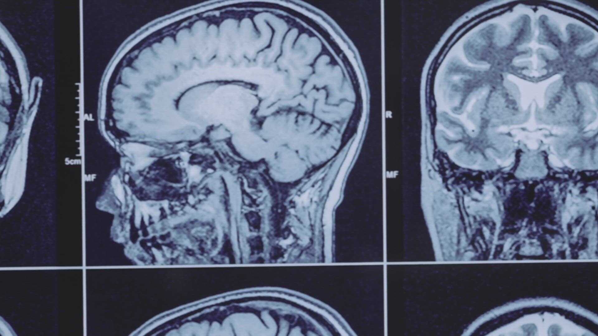 The UnXplained S7E16 Unlocking the Sixth Sense